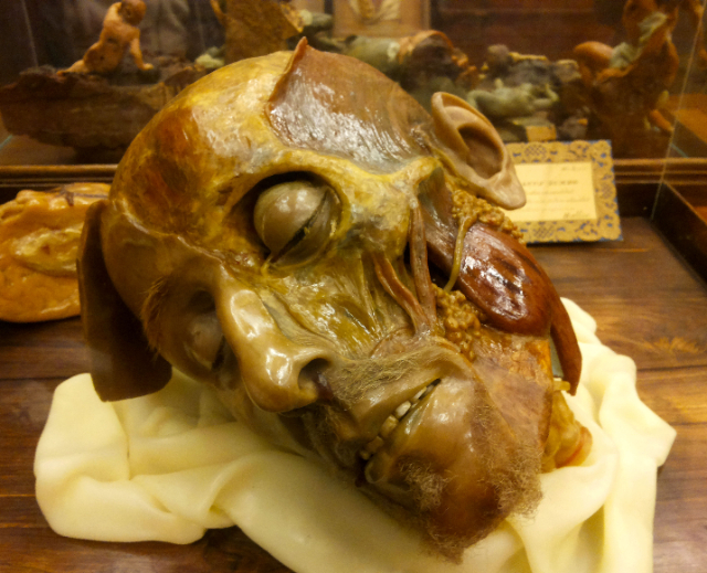 Anatomisk voksmuseum - Cagliari | Secret World Trip Planner